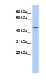 RIMKLA antibody LS-C111679 Western blot of MCF7 cell lysate.