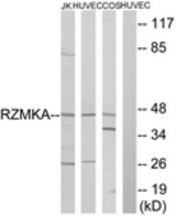 Western blot of extracts from HUVEC/COS/Jurkat cells, using RIMKA Antibody. The lane on the right is treated with the synthesized peptide.
