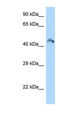 RIMKLB antibody LS-C146358 Western blot of Mouse Kidney lysate. Antibody concentration 1 ug/ml.