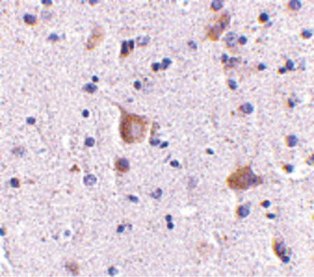 Immunohistochemistry of Rim2 in human brain with Rim2 antibody at 5 ug/ml.