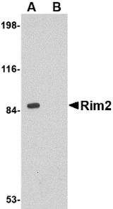 Western blot of Rim2 in rat brain tissue lysate with Rim2 antibody at 1 ug/ml in the (A) absence or (B) presence of blocking peptide.