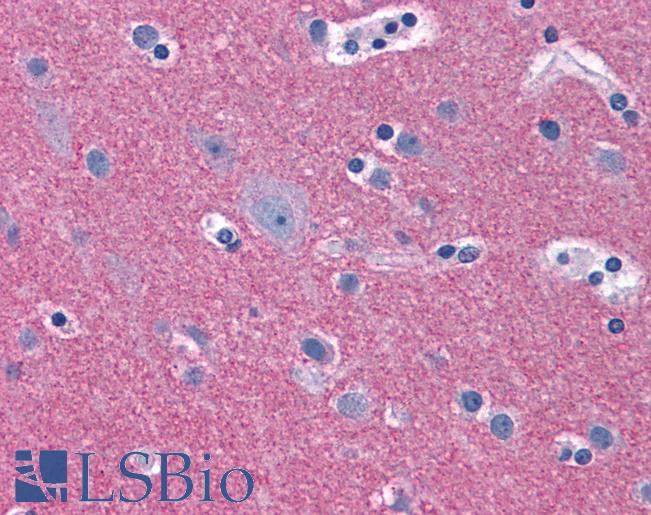 Anti-RIMS2 antibody IHC of human brain, cortex. Immunohistochemistry of formalin-fixed, paraffin-embedded tissue after heat-induced antigen retrieval. Antibody LS-B4711 concentration 5 ug/ml.