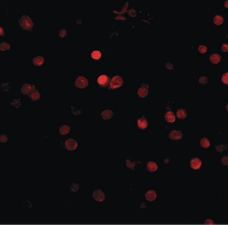 Immunofluorescence of rim3 in human brain tissue with rim3 antibody at 5 ug/ml.