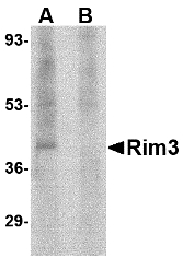 Western blot of Rim3 in human brain tissue lysate with Rim3 antibody at 1 ug/ml in the (A) absence and (B) presence of blocking peptide.
