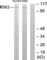 Western blot of extracts from HUVEC/K562 cells, using RIN3 Antibody. The lane on the right is treated with the synthesized peptide.