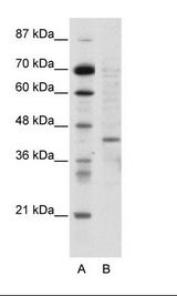 A: Marker, B: HepG2 Cell Lysate