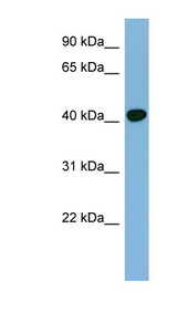 RING1 antibody LS-C107934 Western blot of COLO205 cell lysate.