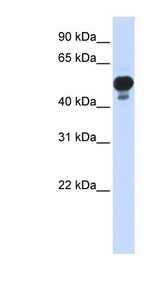 RING1 antibody LS-C109759 Western blot of Transfected 293T cell lysate.