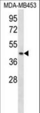RING1 Antibody western blot of MDA-MB453 cell line lysates (35 ug/lane). The RING1 antibody detected the RING1 protein (arrow).