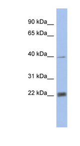 PSMA4 antibody LS-C110901 Western blot of Fetal Heart lysate.