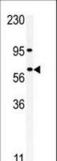 Western blot of anti-RIOK1 antibody in A375 cell line lysate. RIOK1(arrow) was detected using the purified antibody.