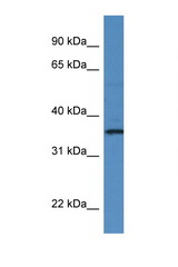 RIOK1 antibody LS-C135838 Western blot of PANC1 Cell lysate. Antibody concentration 1 ug/ml.