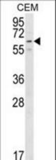 Western blot of RIOK2 Center in CEM cell line lysates (35 ug/lane). RIOK2 (arrow) was detected using the purified antibody.