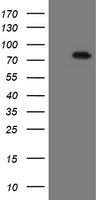 HEK293T cells were transfected with the pCMV6-ENTRY control (Left lane) or pCMV6-ENTRY RIOK2 (Right lane) cDNA for 48 hrs and lysed. Equivalent amounts of cell lysates (5 ug per lane) were separated by SDS-PAGE and immunoblotted with anti-RIOK2.