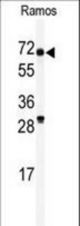 Western blot of anti-RIOK2 Antibody in Ramos cell line lysates (35 ug/lane). RIOK2(arrow) was detected using the purified antibody.