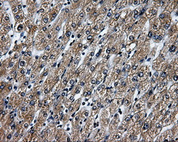 IHC of paraffin-embedded liver tissue using anti-RALBP1 mouse monoclonal antibody. (Dilution 1:50).