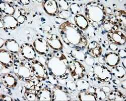 IHC of paraffin-embedded Kidney tissue using anti-RALBP1 mouse monoclonal antibody. (Dilution 1:50).