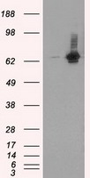 HEK293T cells were transfected with the pCMV6-ENTRY control (Left lane) or pCMV6-ENTRY RALBP1 (Right lane) cDNA for 48 hrs and lysed. Equivalent amounts of cell lysates (5 ug per lane) were separated by SDS-PAGE and immunoblotted with anti-RALBP1.