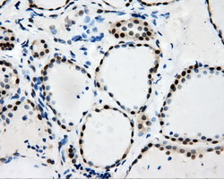 IHC of paraffin-embedded thyroid tissue using anti-RALBP1 mouse monoclonal antibody. (Dilution 1:50).