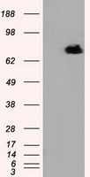 HEK293T cells were transfected with the pCMV6-ENTRY control (Left lane) or pCMV6-ENTRY RALBP1 (Right lane) cDNA for 48 hrs and lysed. Equivalent amounts of cell lysates (5 ug per lane) were separated by SDS-PAGE and immunoblotted with anti-RALBP1.