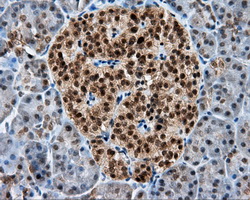IHC of paraffin-embedded pancreas tissue using anti-RALBP1 mouse monoclonal antibody. (Dilution 1:50).
