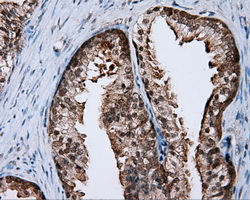 IHC of paraffin-embedded prostate tissue using anti-RALBP1 mouse monoclonal antibody. (Dilution 1:50).