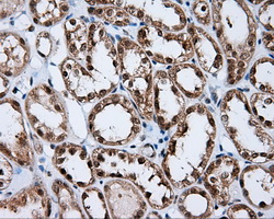 IHC of paraffin-embedded Kidney tissue using anti-RALBP1 mouse monoclonal antibody. (Dilution 1:50).