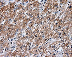 IHC of paraffin-embedded liver tissue using anti-RALBP1 mouse monoclonal antibody. (Dilution 1:50).