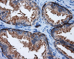IHC of paraffin-embedded prostate tissue using anti-RALBP1 mouse monoclonal antibody. (Dilution 1:50).