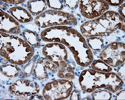 IHC of paraffin-embedded Kidney tissue using anti-RALBP1 mouse monoclonal antibody. (Dilution 1:50).
