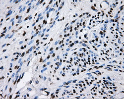 IHC of paraffin-embedded endometrium tissue using anti-RALBP1 mouse monoclonal antibody. (Dilution 1:50).