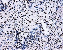 IHC of paraffin-embedded Ovary tissue using anti-RALBP1 mouse monoclonal antibody. (Dilution 1:50).