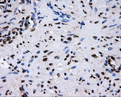 IHC of paraffin-embedded prostate tissue using anti-RALBP1 mouse monoclonal antibody. (Dilution 1:50).