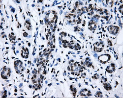 IHC of paraffin-embedded breast tissue using anti-RALBP1 mouse monoclonal antibody. (Dilution 1:50).