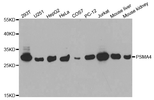 Western blot analysis of extracts of various cell lines, using PSMA4 antibody.