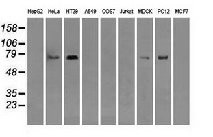 Western blot of extracts (35 ug) from 9 different cell lines by using anti-RALBP1 monoclonal antibody.