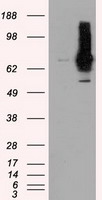 HEK293T cells were transfected with the pCMV6-ENTRY control (Left lane) or pCMV6-ENTRY RALBP1 (Right lane) cDNA for 48 hrs and lysed. Equivalent amounts of cell lysates (5 ug per lane) were separated by SDS-PAGE and immunoblotted with anti-RALBP1.