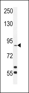 dik Antibody western blot of mouse liver tissue lysates (35 ug/lane). The ANKRD3 antibody detected the dik protein (arrow).