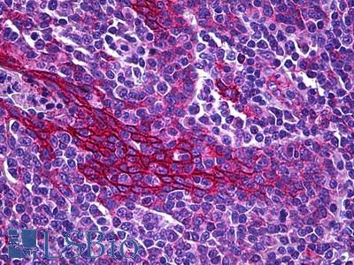Anti-RIPK4 antibody IHC of human tonsil, mucosa. Immunohistochemistry of formalin-fixed, paraffin-embedded tissue after heat-induced antigen retrieval. Antibody LS-B6134 concentration 3.75 ug/ml.