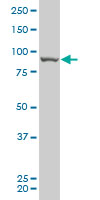 RIPK4 monoclonal antibody (M05), clone 2D1 Western blot of RIPK4 expression in A-431.