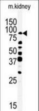 Western blot of anti-ANKRD3-Q817 antibody in mouse kidney tissue lysate (35 ug/lane). ANKRD3-Q817(arrow) was detected using the purified antibody.