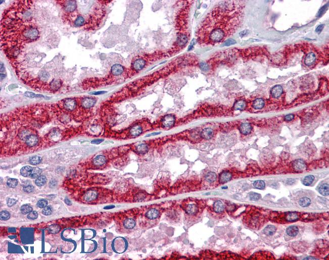 Anti-RIPK1 /RIP antibody IHC of human kidney. Immunohistochemistry of formalin-fixed, paraffin-embedded tissue after heat-induced antigen retrieval. Antibody LS-B4613 concentration 5 ug/ml.
