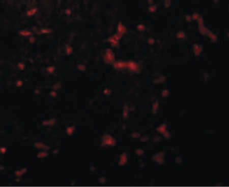 Immunofluorescence of RIPK1 in Mouse Kidney cells with RIPK1 antibody at 20 ug/ml.