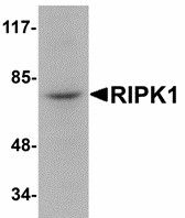 Western blot of RIPK1 in rat kidney tissue lysate with RIPK1 antibody at 1 ug/ml.
