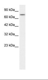 Jurkat Cell Lysate