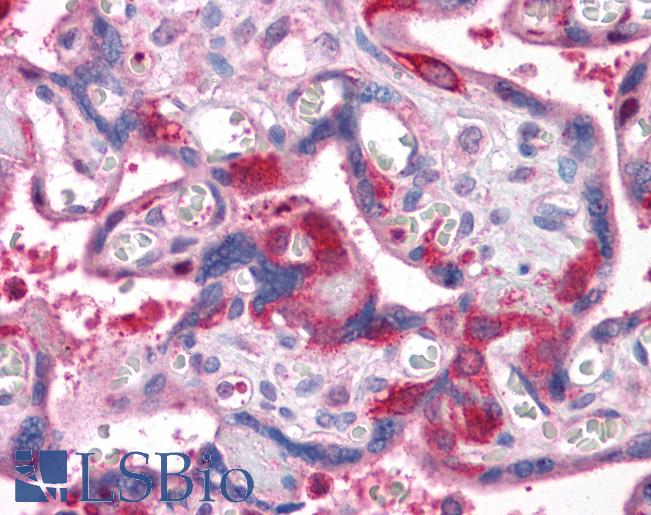Anti-RIPK1 /RIP antibody IHC of human placenta. Immunohistochemistry of formalin-fixed, paraffin-embedded tissue after heat-induced antigen retrieval. Antibody LS-B4701 concentration 5 ug/ml.