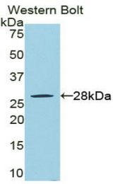 Western blot of recombinant RIPK3 / RIP3.
