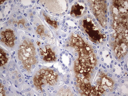 IHC of paraffin-embedded Human Kidney tissue using anti-RIPK3 mouse monoclonal antibody. (Heat-induced epitope retrieval by 1 mM EDTA in 10mM Tris, pH9.0, 120°C for 3min).