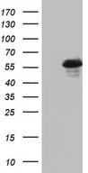HEK293T cells were transfected with the pCMV6-ENTRY control (Left lane) or pCMV6-ENTRY RIPK3 (Right lane) cDNA for 48 hrs and lysed. Equivalent amounts of cell lysates (5 ug per lane) were separated by SDS-PAGE and immunoblotted with anti-RIPK3.