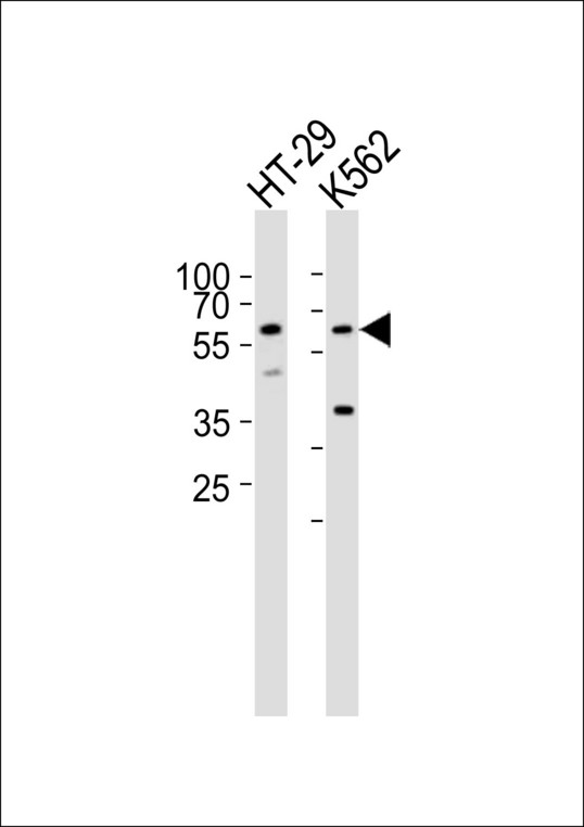 Western blot of lysates from HT-29, K562 cell line (from left to right), using RIPK3 Antibody Center. Antibody was diluted at 1:1000 at each lane. A goat anti-rabbit IgG H&L (HRP) at 1:10000 dilution was used as the secondary antibody. Lysates at 35ug per lane.